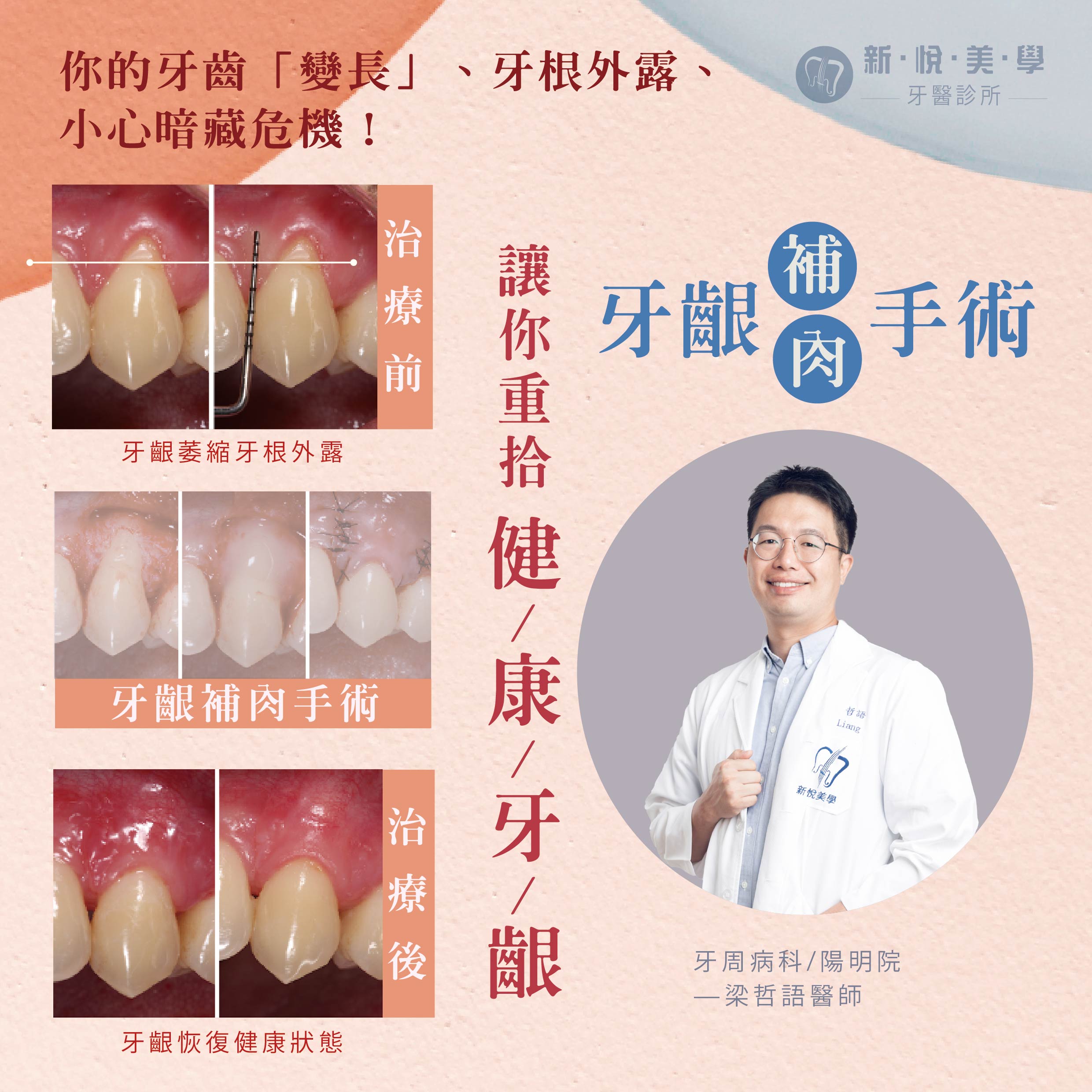 新悅美學牙醫診所的案例分享圖片